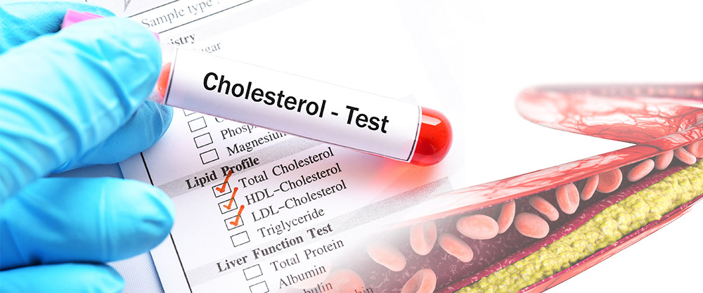 Cholesterol Test