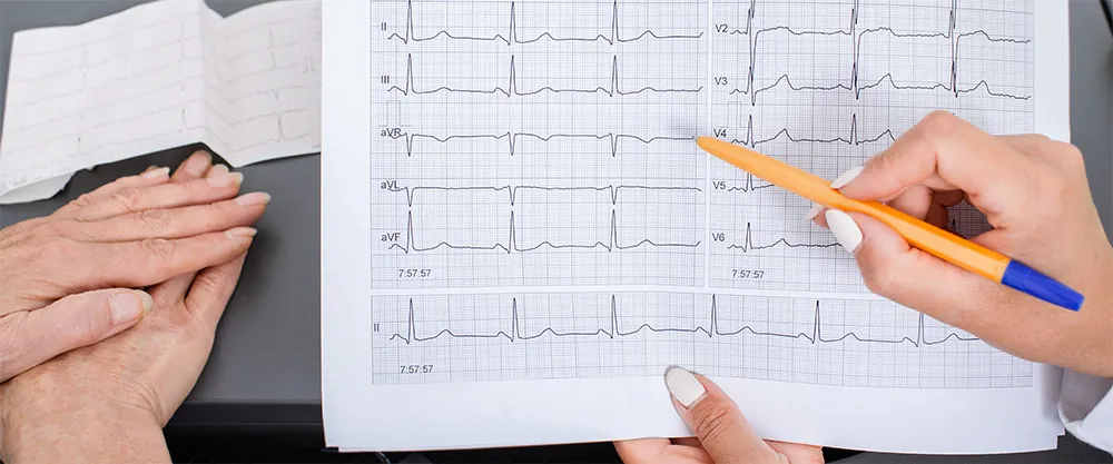 Ekg