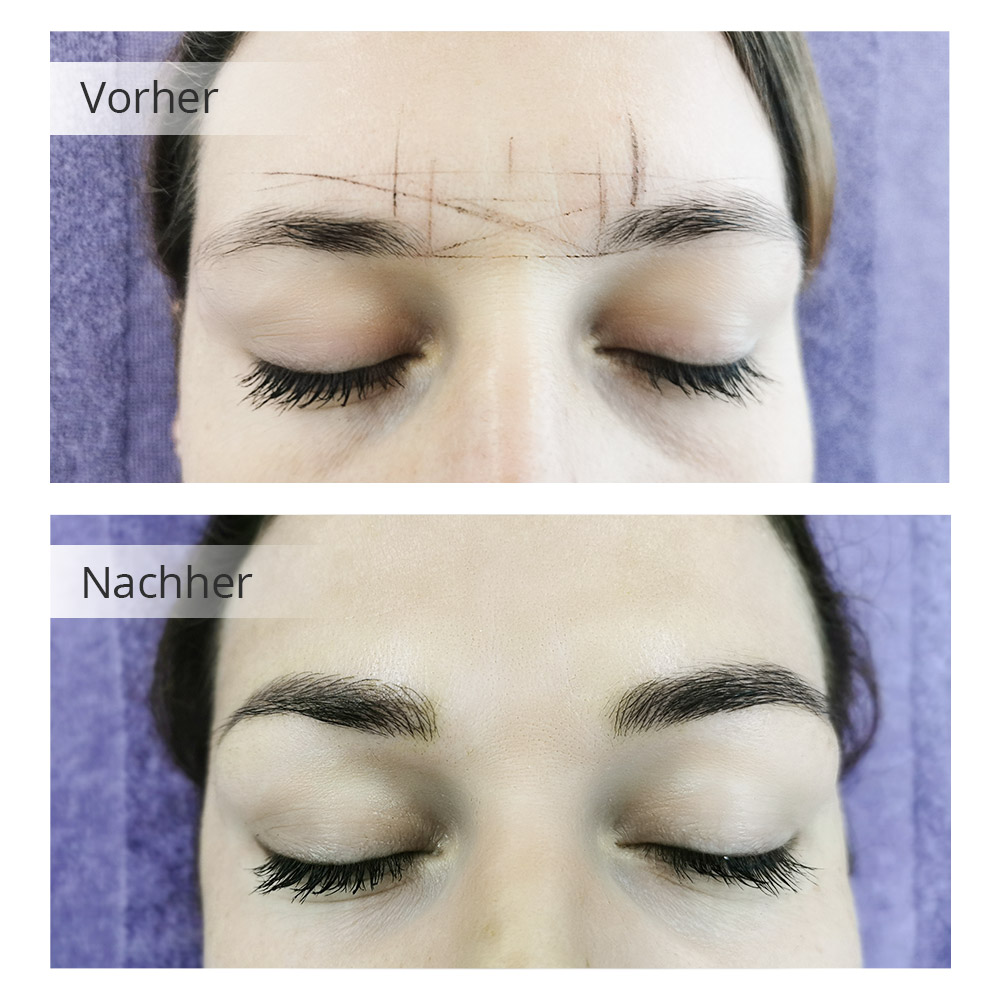 Vorher-Nachher Vergleich von Microblading